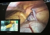 Obraz z kamery laparoskopowej - przekaz do Sali Konferencyjnej